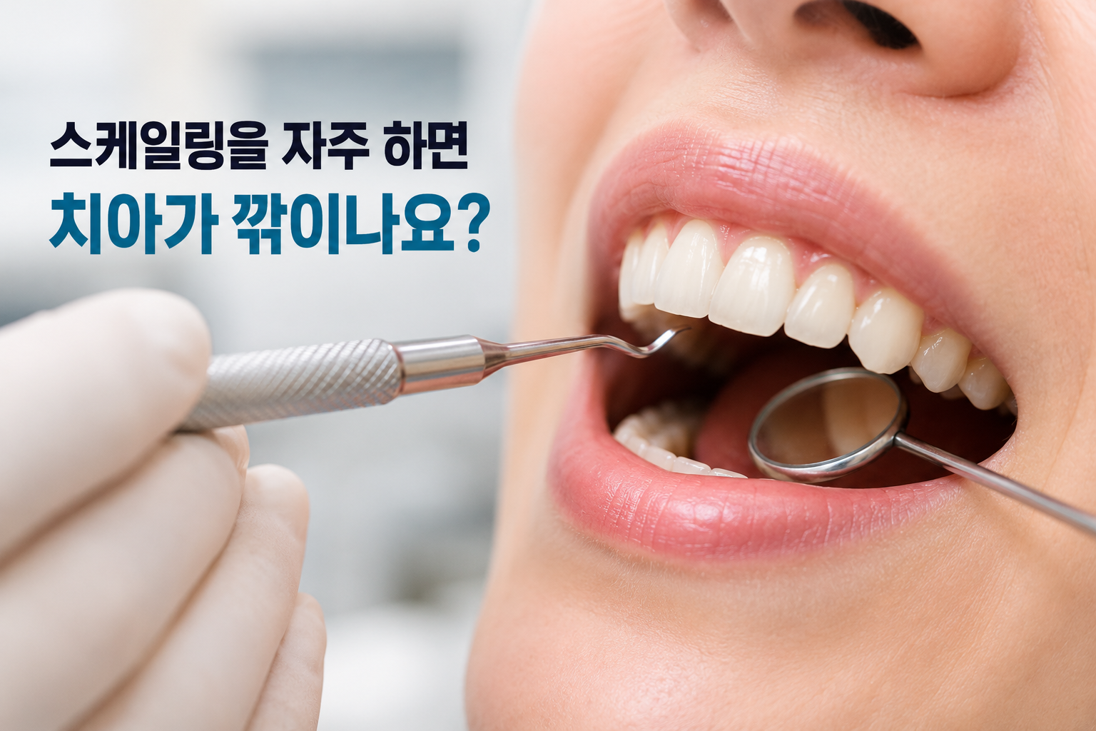 스케일링을 자주 하면 치아가 깎이나요?