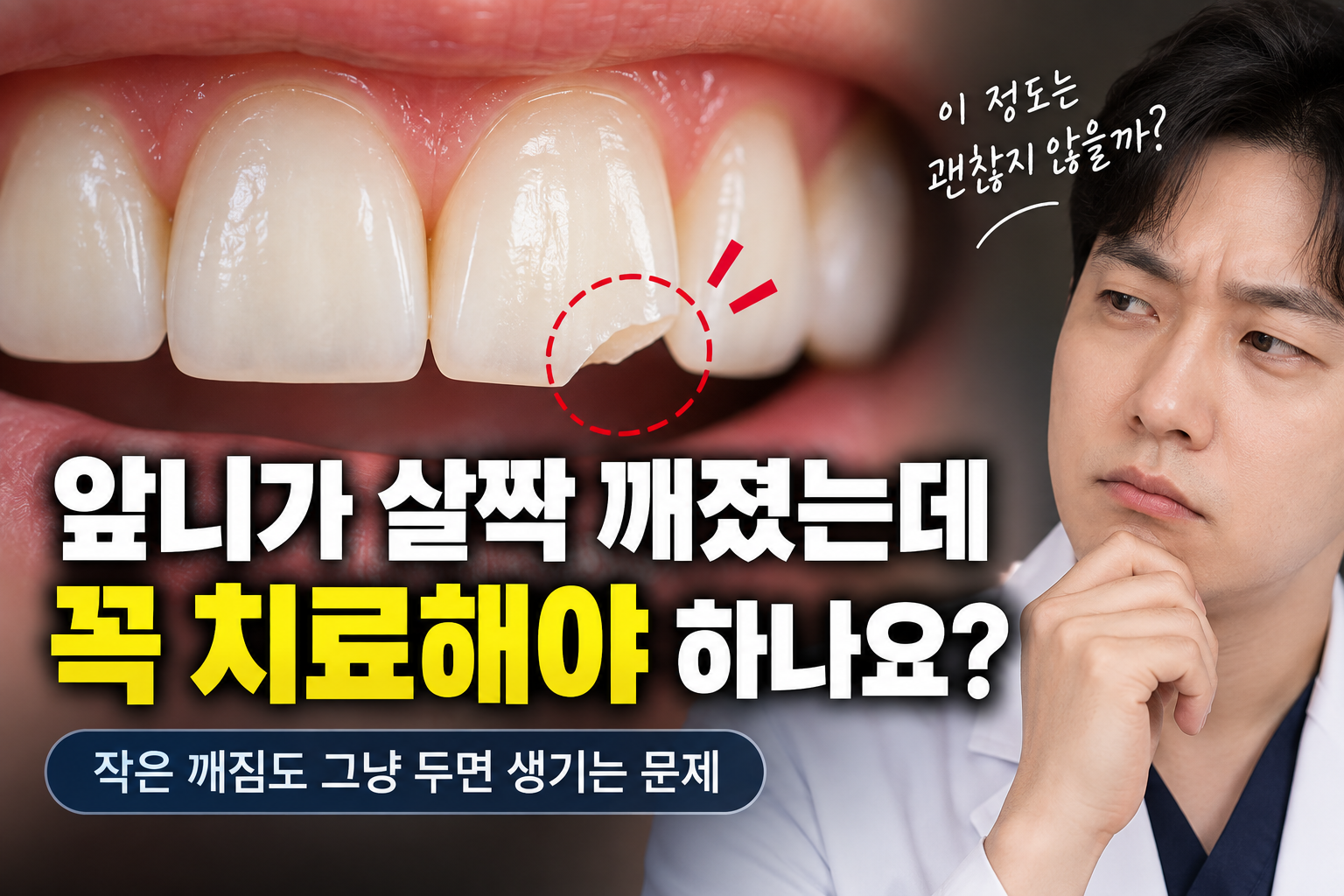 앞니가 살짝 깨졌는데 꼭 치료해야 하나요?
