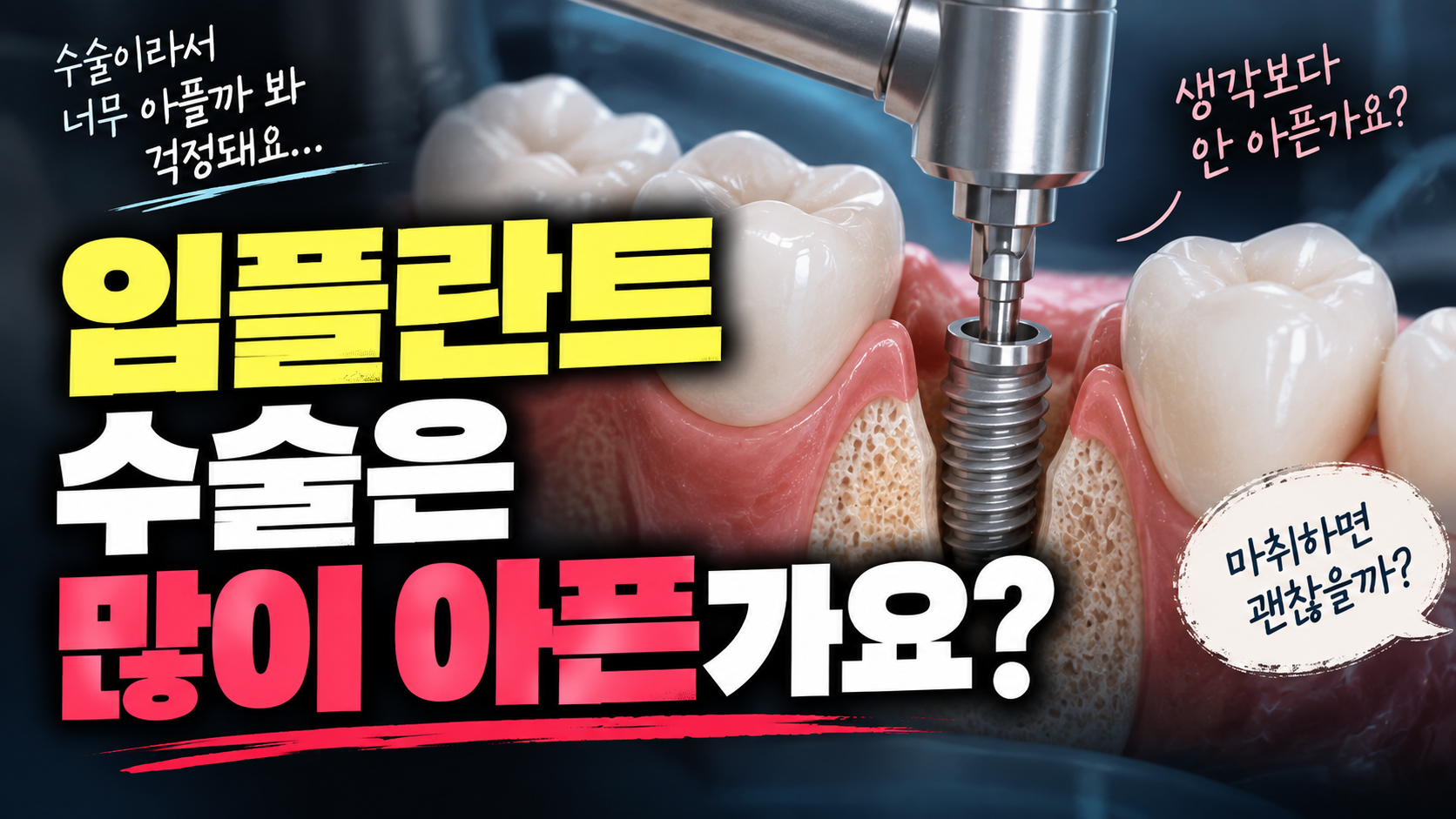 임플란트 수술은 많이 아픈가요?