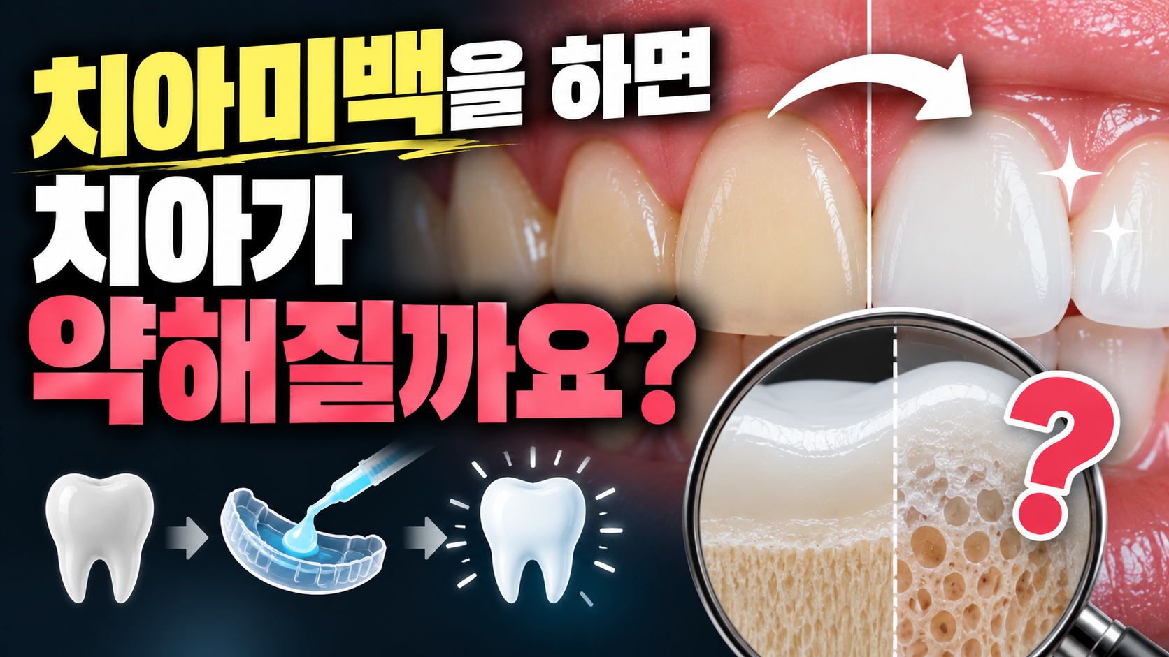 치아미백을 하면 치아가 약해질까요?