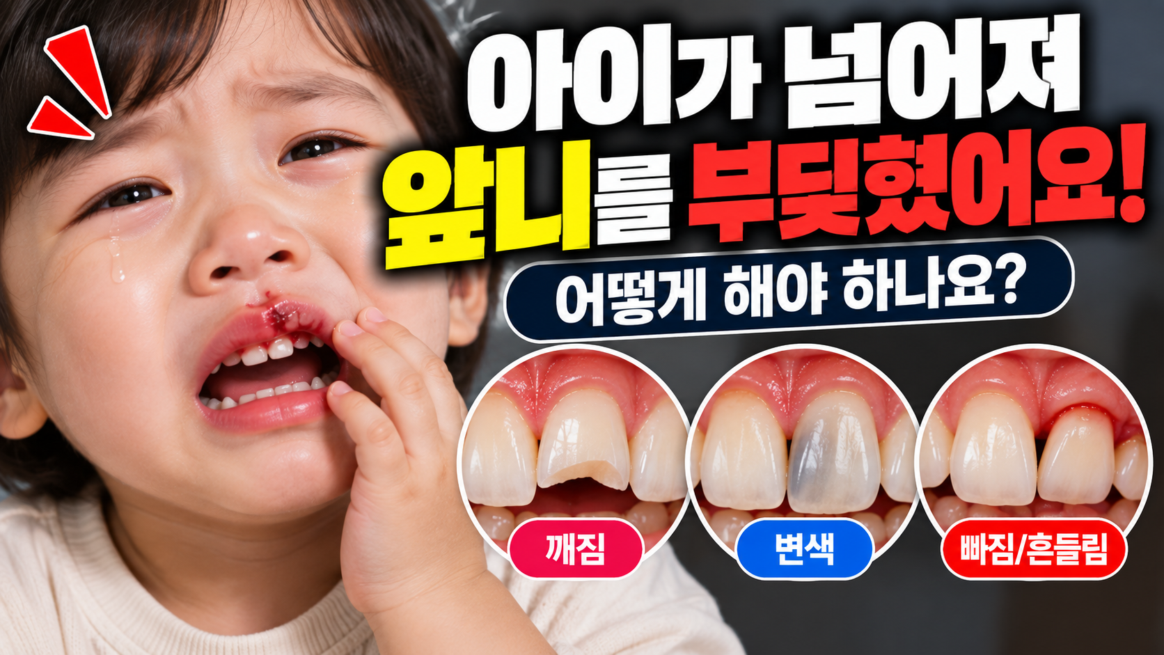 아이가 넘어져 앞니를 부딪혔어요. 어떻게 해야 하나요?