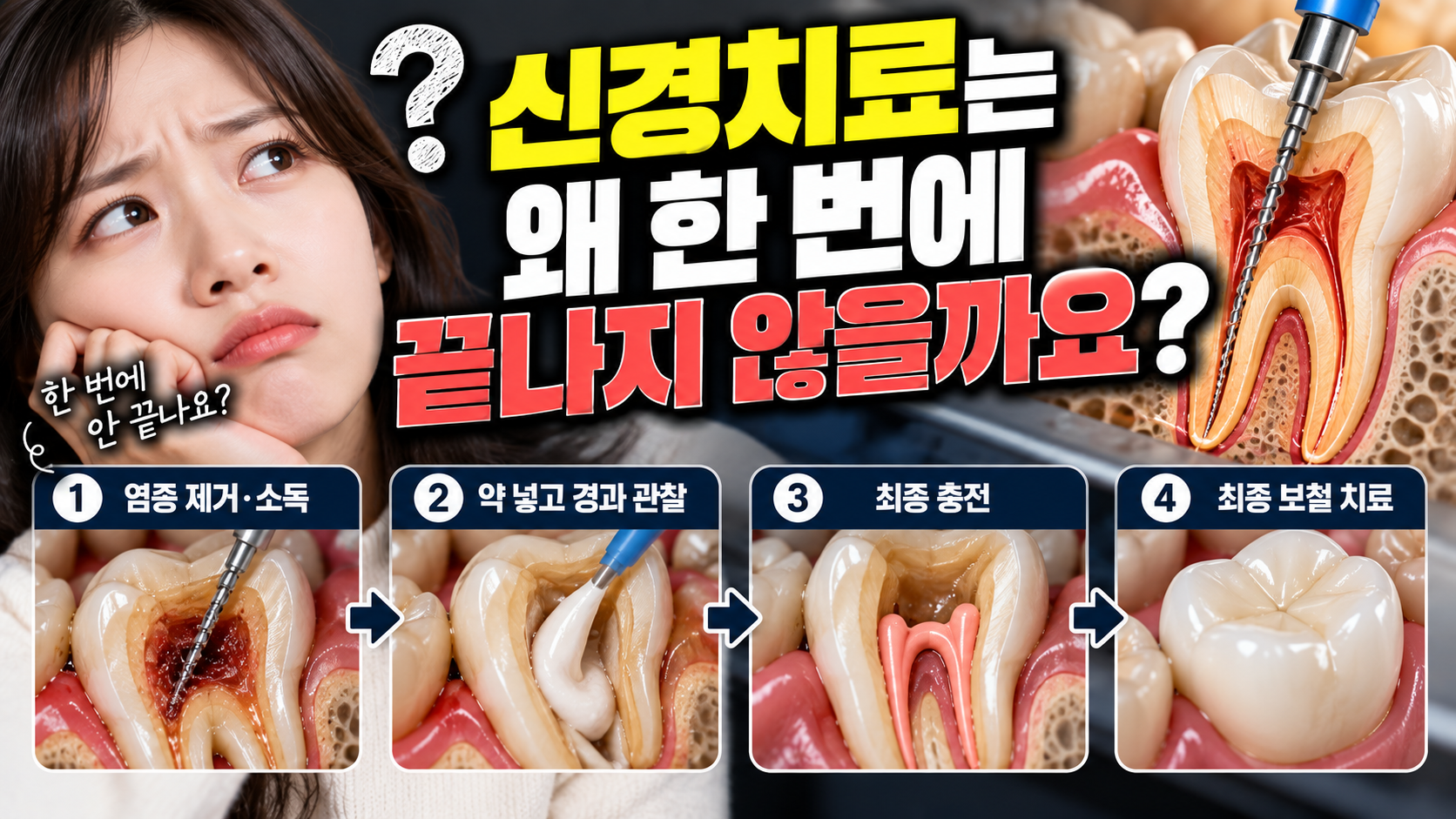 신경치료는 왜 한 번에 끝나지 않을까요?