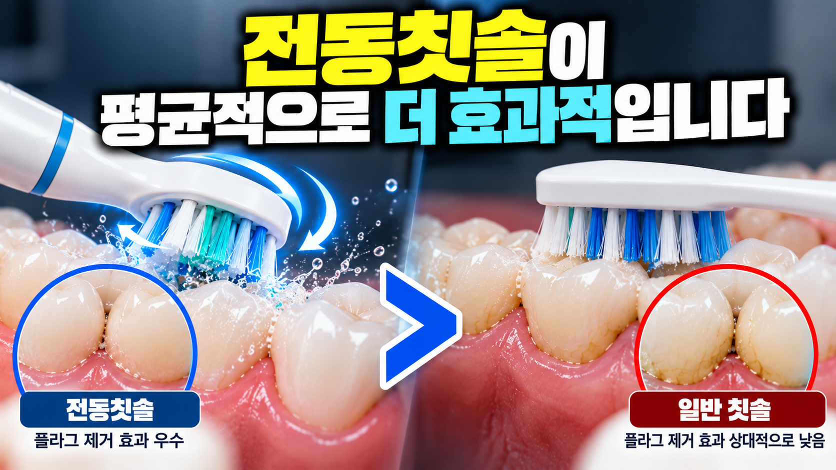 전동칫솔이 일반 칫솔보다 더 좋은가요? — 본문 이미지 1