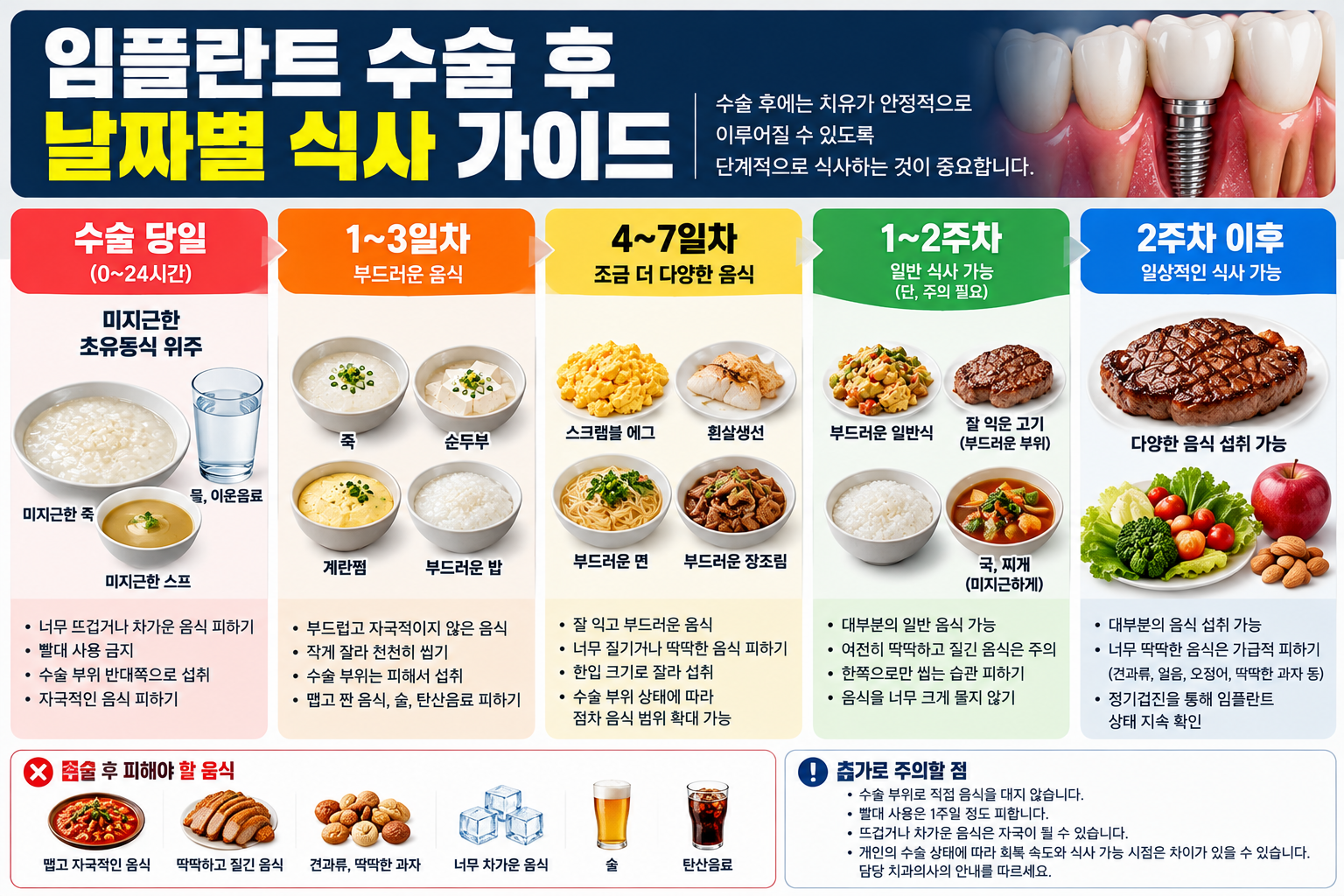 임플란트 수술 후 언제부터 식사할 수 있나요? — 본문 이미지 1